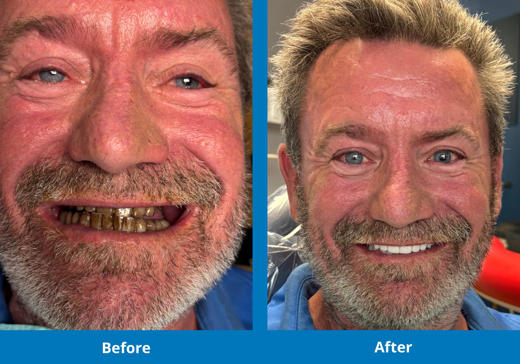 Access-Dental-before-after-04
